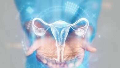 Photo of Qué es la endometriosis y por qué es importante el diagnóstico temprano