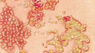 Photo of Los distintos tipos de herpes y sus efectos en la salud