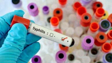 Photo of Alerta sífilis: aumento de casos con síntomas atípicos y graves en Estados Unidos