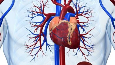Photo of Cateterismo cardiaco: un estudio afirmó que no es necesario ayunar antes de la operación