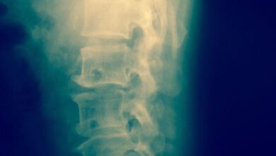 Photo of Un dispositivo que rodea la médula espinal podría ayudar a tratar la parálisis