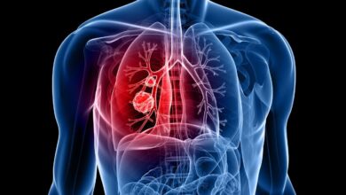 Photo of Cáncer de pulmón: cómo funciona la nueva inmunoterapia aprobada por la Anmat que busca prevenir las recaídas