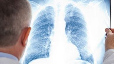Photo of Cáncer de pulmón: la inmunoterapia aumenta la supervivencia antes y después de la cirugía