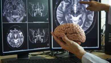 Photo of Las fobias de los adultos se manifiestan como cambios en el cerebro