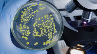 Photo of Una bacteria estreptocócica mortal se está propagando en Japón