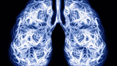 Photo of Cómo es el tratamiento para el cáncer de pulmón que prolonga la vida de los pacientes