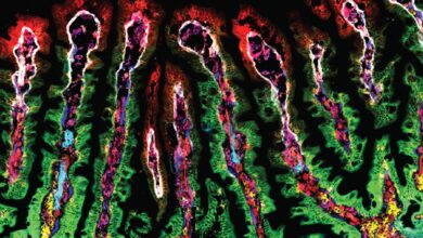 Photo of El primer mapa detallado del intestino humano: revelaron cómo absorbe los nutrientes y refuerza el sistema inmune