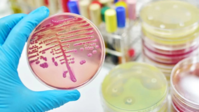 Photo of Cómo es la superbacteria Klebsiella que consigue eludir a los antibióticos