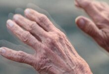 Photo of Parkinson: un avance científico argentino podría cambiar el paradigma del tratamiento