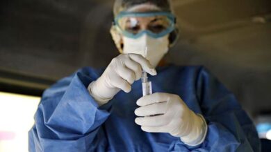 Photo of Conicet detectó atrofia cerebral en pacientes con covid prolongado