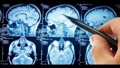 Photo of Cómo cuidar la salud cerebral en las distintas etapas de la vida
