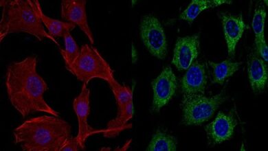 Photo of Científicos argentinos investigan el uso de ivermectina para potenciar la inmunoterapia contra el cáncer colorrectal