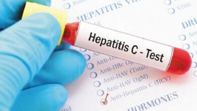 Photo of Millones de personas padecen hepatitis y no lo saben