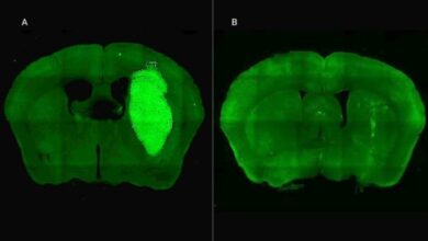 Photo of Científicos del CONICET desarrollan estrategia experimental para frenar el glioblastoma