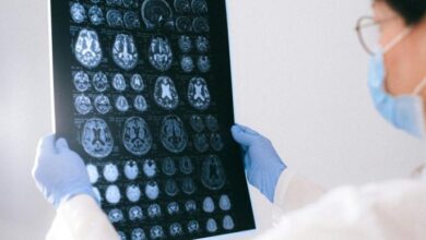 Photo of Identifican en sangre biomarcadores relevantes para el diagnóstico y el seguimiento de pacientes con epilepsia