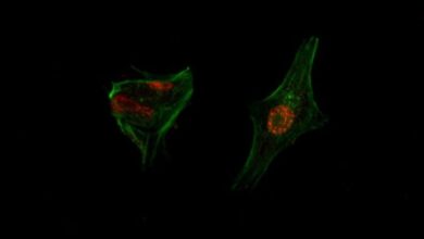 Photo of Un adenovirus oncolítico argentino logró suprimir metástasis hepáticas en modelos experimentales