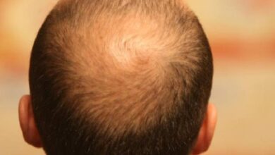 Photo of La ciencia advierte que el alcohol podría favorecer la calvicie